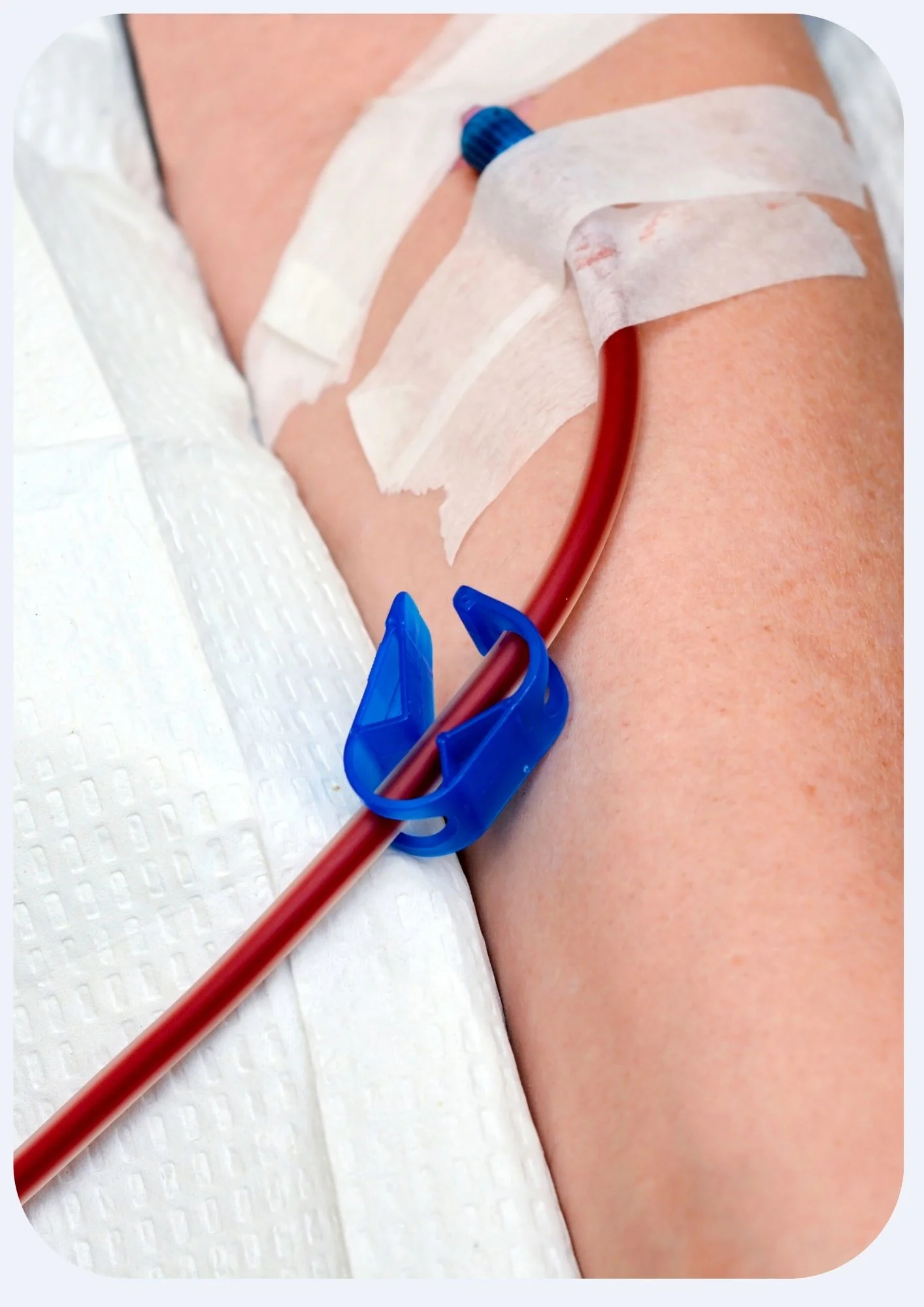 OZONE THERAPY